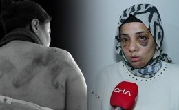 Eski eşe aile boyu dayak: Gözümde sigara söndürüldü