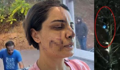 ’40 dikişli’ dehşette korkunç detaylar: Ağaca tırmanıp saklandı, taksiyle kapısına dayandı